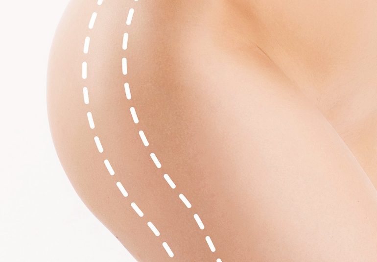 Cirugía Plástica | Láser | Cirugía Estético | Clínica Láser | Depilación Láser | Belleza Facial | Rinoplastia |Lifting | Limpieza Facial | Rinoplastia | Lipoescultura | Rejuvenecimiento Facial | Mesoterapia |Radiofrecuencia |Laser Depilación |Microdermoabrasión |Limpiezas Faciales | VIP