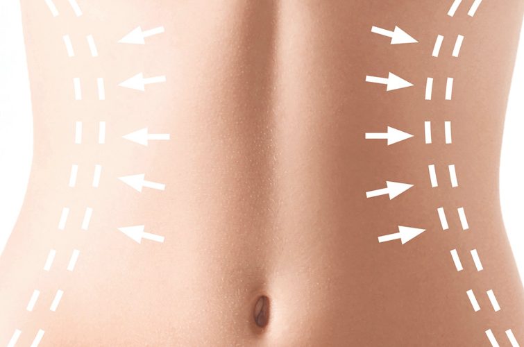 Cirugia Plastica Quito | Cirujano Plastico Quito | Cirujano Plastico Ecuador | Rinoplastia en Ecuador | Mamoplastia de aumento | Abdominoplastia Lipoescultura | Acido hialuronico | Hilos tensores | Cirugia estetica en Ecuador | Clinica Laser | Reduccion corporal sin Cirugia | Quitar tatuajes con laser Ecuador | Blefaroplastia | Lifting facial | Mommy makeover | post-embarazo para recuperar la figura | VIP