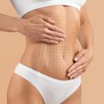 Cirugia Plastica Quito | Cirujano Plastico Quito | Cirujano Plastico Ecuador | Rinoplastia en Ecuador | Mamoplastia de aumento | Abdominoplastia Lipoescultura | Acido hialuronico | Hilos tensores | Cirugia estetica en Ecuador | Clinica Laser | Reduccion corporal sin Cirugia | Quitar tatuajes con laser Ecuador | Blefaroplastia | Lifting facial | Mommy makeover | post-embarazo para recuperar la figura | VIP