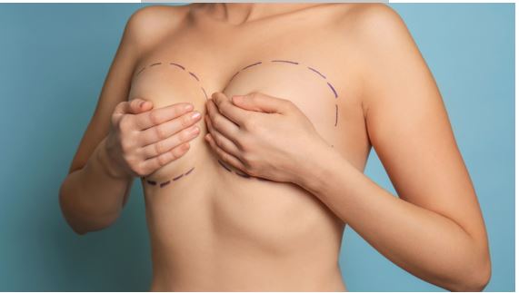 Cirugia Plastica Quito | Cirujano Plastico Quito | Cirujano Plastico Ecuador | Rinoplastia en Ecuador | Mamoplastia de aumento | Abdominoplastia Lipoescultura | Acido hialuronico | Hilos tensores | Cirugia estetica en Ecuador | Clinica Laser | Reduccion corporal sin Cirugia | Quitar tatuajes con laser Ecuador | Blefaroplastia | Lifting facial | Mommy makeover | post-embarazo para recuperar la figura | VIP