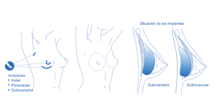 Paciente feliz mostrando confianza tras mamoplastia segura en Quito