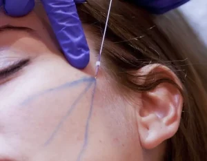 Cirugia Plastica Quito | Cirujano Plastico Quito | Cirujano Plastico Ecuador | Rinoplastia en Ecuador | Mamoplastia de aumento | Abdominoplastia Lipoescultura | Acido hialuronico | Hilos tensores | Cirugia estetica en Ecuador | Clinica Laser | Reduccion corporal sin Cirugia | Quitar tatuajes con laser Ecuador | Blefaroplastia | Lifting facial | Mommy makeover | post-embarazo para recuperar la figura | VIP