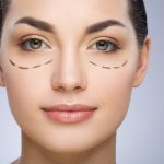 Blefaroplastia Cirugía de Párpados en Quito | Otoplastia o cirugía de las orejas | Mini Lipoescultura | Mini Abdominoplastia | Lipoescultura y Perfilamiento Glúteo |Lifting Gluteo | Lifting Facial | Levantamiento Crural | Levantamiento Cejas | Frontoplastia | Cirugía Plástica | Láser | Cirugía Estético | Clínica Láser | Depilación Láser | Belleza Facial | Rinoplastia |Lifting | Limpieza Facial | Rinoplastia | Lipoescultura | Rejuvenecimiento Facial | Mesoterapia |Radiofrecuencia |Laser Depilación |Microdermoabrasión |Limpiezas Faciales | Hilos Tensores | Hilos Tensores Cara | Hilos Tensores Nariz | Lifting Facial | Acido Hialurónico en glúteos |Estetica Cirugia | VIP