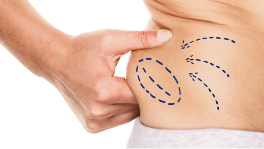 Cirugia Plastica Quito | Cirujano Plastico Quito | Cirujano Plastico Ecuador | Rinoplastia en Ecuador | Mamoplastia de aumento | Abdominoplastia Lipoescultura | Acido hialuronico | Hilos tensores | Cirugia estetica en Ecuador | Clinica Laser | Reduccion corporal sin Cirugia | Quitar tatuajes con laser Ecuador | Blefaroplastia | Lifting facial | Mommy makeover | post-embarazo para recuperar la figura | VIP