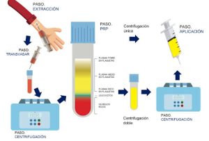 cirugia plastica | cirugia estetica Cirugia Plastica Quito | Cirujano Plastico Quito | Cirujano Plastico Ecuador | Rinoplastia en Ecuador | Mamoplastia de aumento | Abdominoplastia Lipoescultura | Acido hialuronico | Hilos tensores | Cirugia estetica en Ecuador | Clinica Laser | Reduccion corporal sin Cirugia | Quitar tatuajes con laser Ecuador | Blefaroplastia | Lifting facial | Mommy makeover | post-embarazo para recuperar la figura | VIP