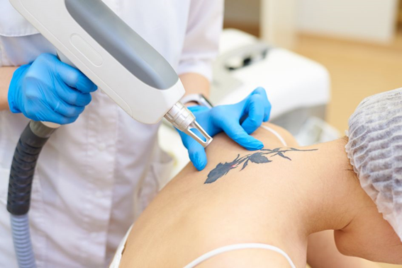 REMOCION DE TATUAJES Cirugia Plastica Quito | Cirujano Plastico Quito | Cirujano Plastico Ecuador | Rinoplastia en Ecuador | Mamoplastia de aumento | Abdominoplastia Lipoescultura | Acido hialuronico | Hilos tensores | Cirugia estetica en Ecuador | Clinica Laser | Reduccion corporal sin Cirugia | Quitar tatuajes con laser Ecuador | Blefaroplastia | Lifting facial | Mommy makeover | post-embarazo para recuperar la figura | VIP