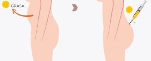 cirugia plastica | cirugia estetica Cirugia Plastica Quito | Cirujano Plastico Quito | Cirujano Plastico Ecuador | Rinoplastia en Ecuador | Mamoplastia de aumento | Abdominoplastia Lipoescultura | Acido hialuronico | Hilos tensores | Cirugia estetica en Ecuador | Clinica Laser | Reduccion corporal sin Cirugia | Quitar tatuajes con laser Ecuador | Blefaroplastia | Lifting facial | Mommy makeover | post-embarazo para recuperar la figura | VIP